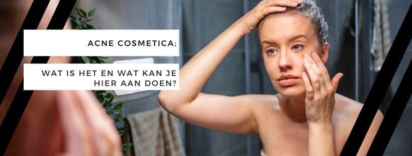 Acne Cosmetica: wat is het en wat kan je hier aan doen